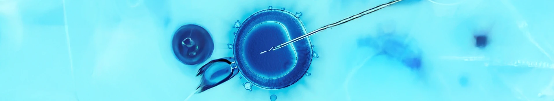 ICSI vs Conventional IVF fertility treatments